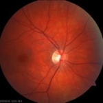 Fundus foto, fotografie (JGK 2016) Fundus foto, fotografie (JGK 2016)