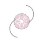 Technis multifocale implantlens bij lensimplantatie