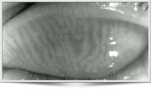 Meibom kliertjes fotografie