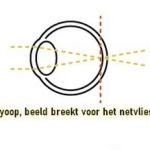 Myoop schematische voorsteling