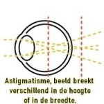 Astigmatisme schematische voorsteling